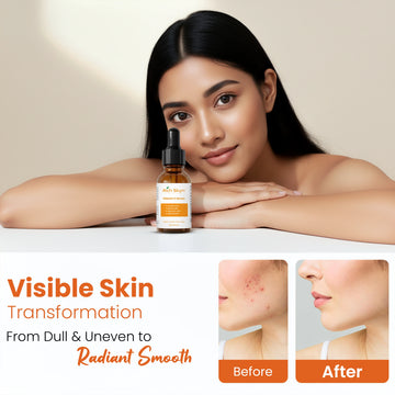 Rich Skyn Vitamin C Serum