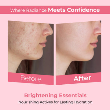 Rich Skyn SPF 50+++ Sunscreen